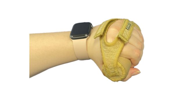 Palmar Hand Cone - Image 3